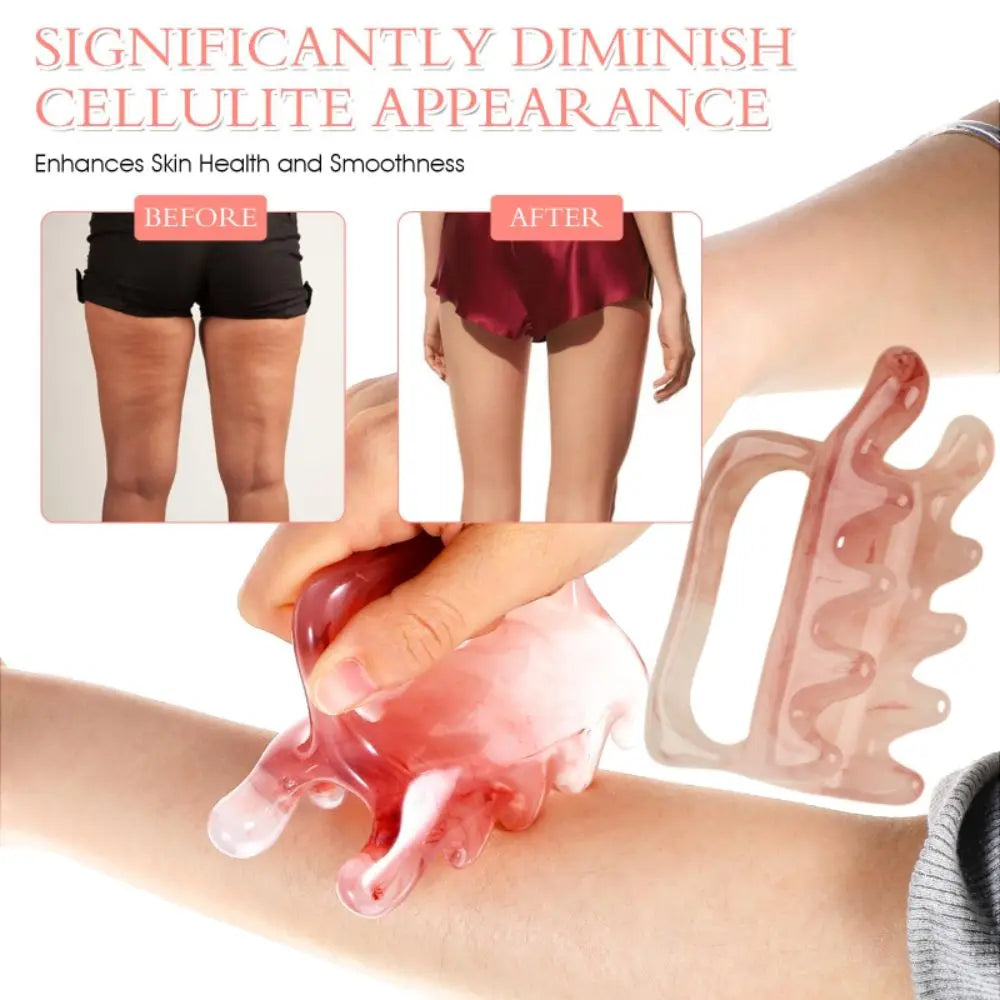 Penelope - Fascia & Cellulite Massage Tool