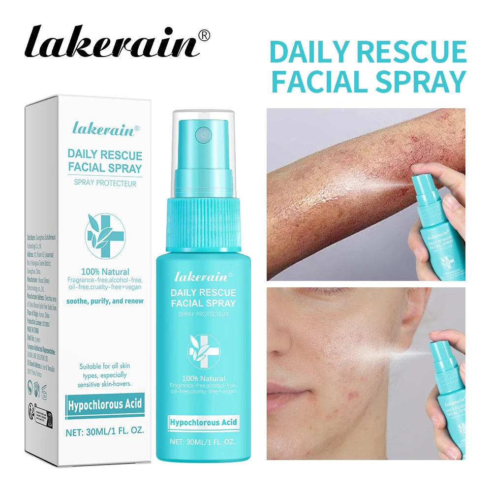 30ml Rescue Facial Spray For Sensitive Skin Hypochlorous Acid Spray Helps Reduce Redness Breakouts Soothing Balancing Spray