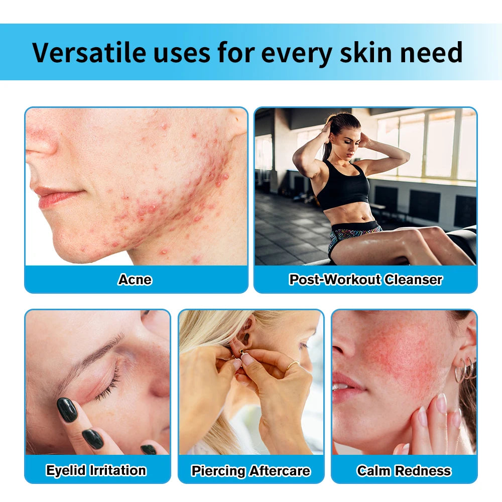 Facial Spray For daily facial Hypochlorous Acid  rescue Reduce redness and acne Versatile uses for every skin need Skin Care